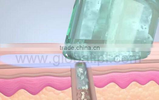 Oxygen water facial skin care jet peel facial equipment wholesale