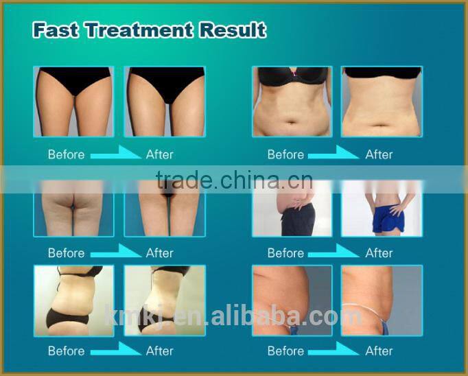 Newest and professional weight loss product