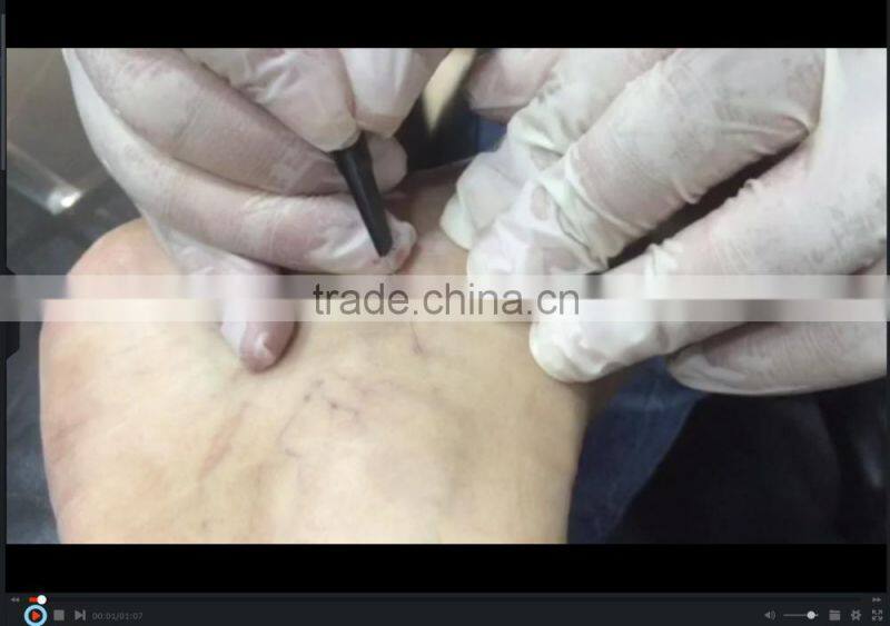 2016 Special promotion !!! High frequency thermocoagulation spider vein removal machine
