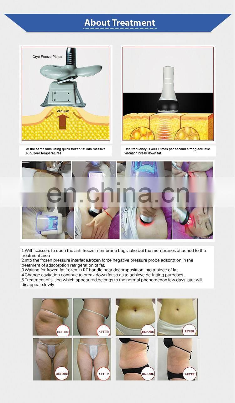 Professional fat freezing machine 2 cryo handles for sale