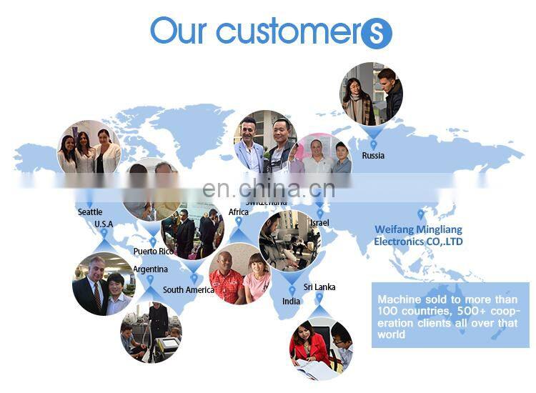 High quality with low cost permanent hair removal machine 755nm 808nm 1064nm diode laser for hair removal