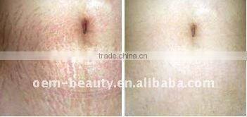 Microneedle derma roller 0.25 till 2.5mm L009