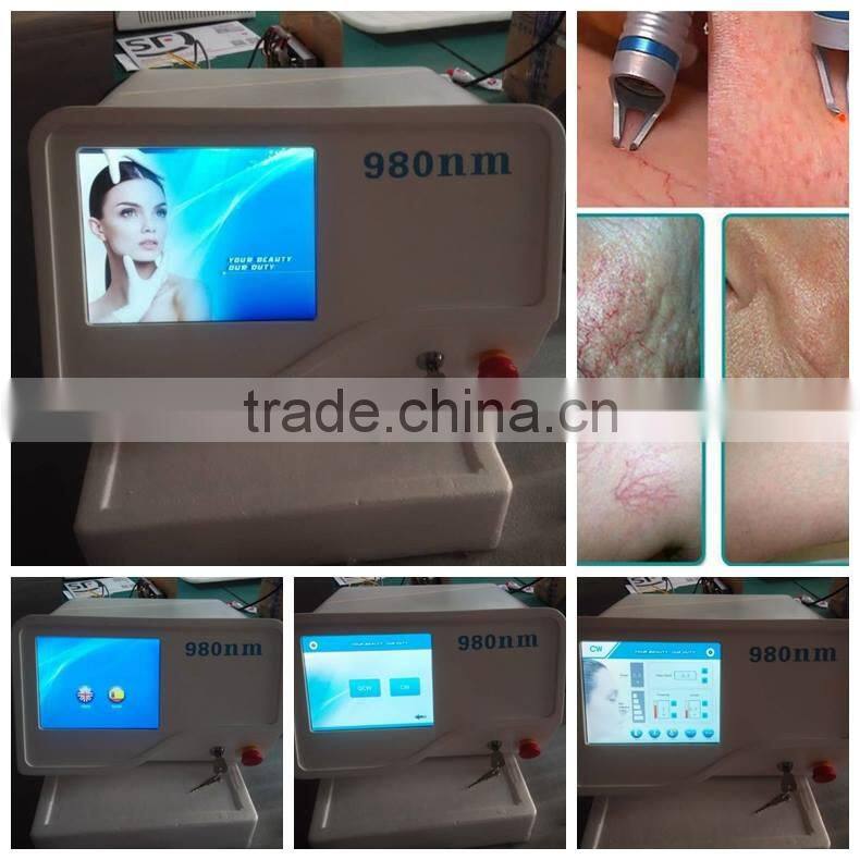 2016 newest Oem Service 980nm diode laser vascular removal machine price
