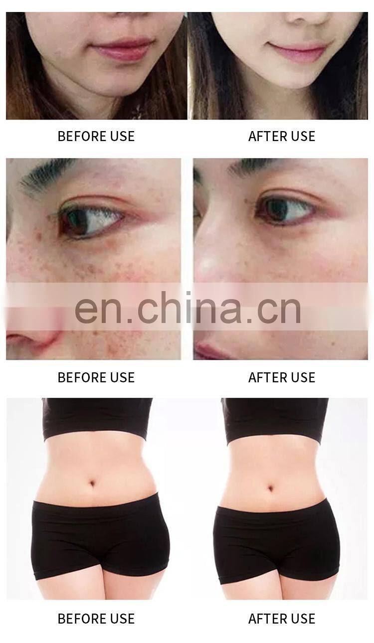 Gold RF Fractional Microneedle Machine Wrinkle Stretch Mark Removal Instrument Skin Tightening Whitening Beauty Device