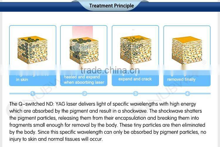 Gentle yag laser 1064nm q-switch nd yag laser tattoo machine