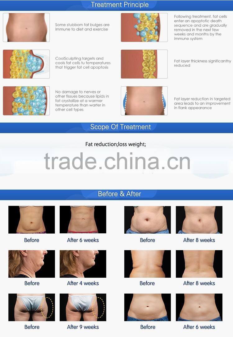 FDA approval slimming cold lipolysis portable kryolipolyse fat freezing cryolipolysis device