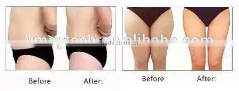 weight loss hifu ultrasound korea slimming machine FU-18S