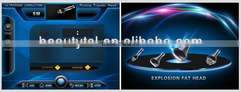 New design cheap 4in1 5mhz rf ultrasonic cavitation machine