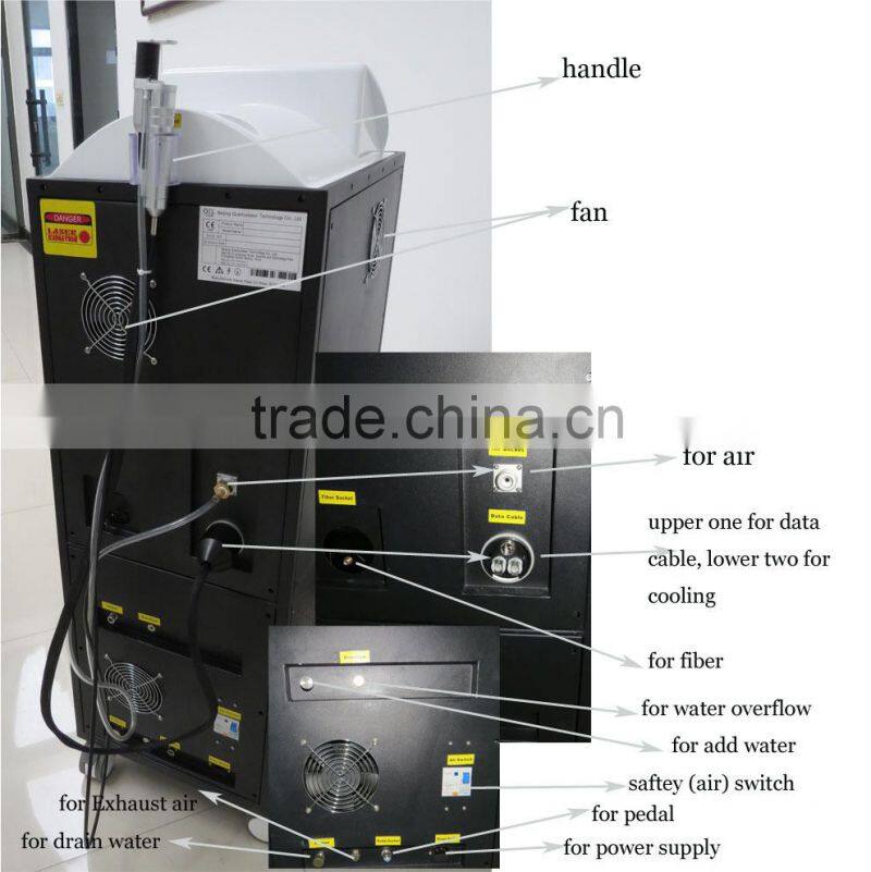 755nm alexandrite laser staple remover machine