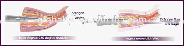 Laser Beauty machine best price pigment remover vagina tightening machine
