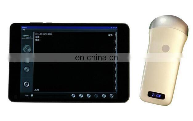 Mini ultrasound scan machine / medical ultrasound scanner probe / Wireless ultrasound