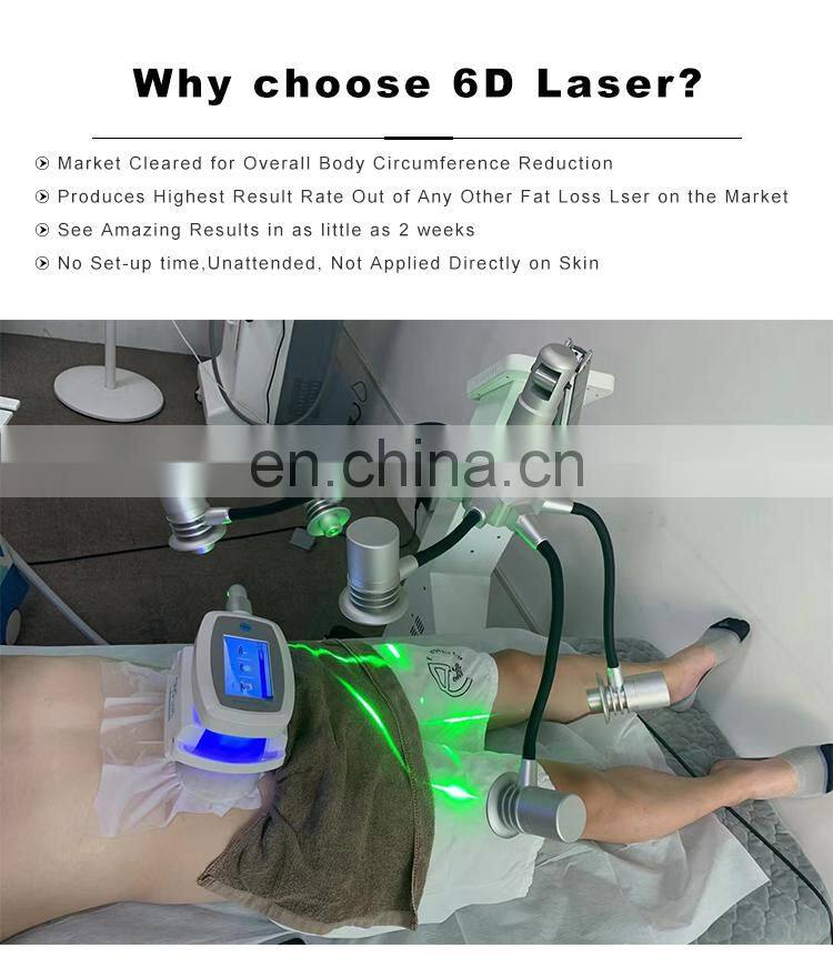 532nm Wavelengths Body slimming machine 6D Laser Non-invasive Weight Loss Shaping Beauty Instrument green laser light Device