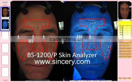 BS-1200P Portable Skin Oil,Wrinkle and Physical Feature Analyzer Face Scanner Machine