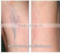 hair loss treatment- medical beauty equipment 1064nm long pulse laser nd yag P003