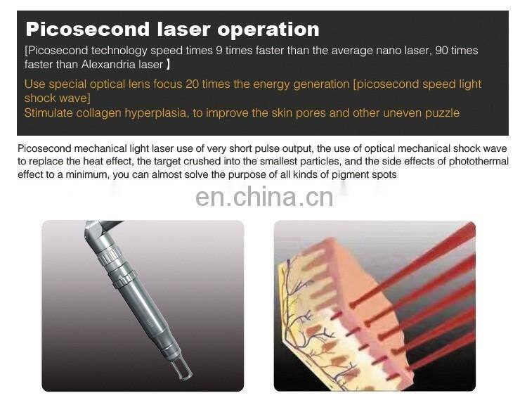 The most popular Tattoo Removal Picosecond Laser