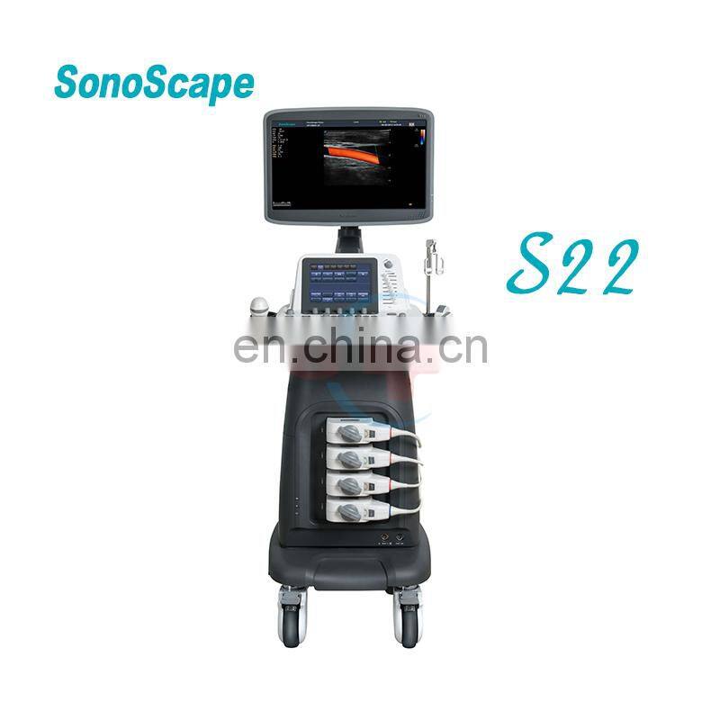 Trolly stand Sonoscape 4D Color Doppler Ultrasound Machine/Sonoscape S22