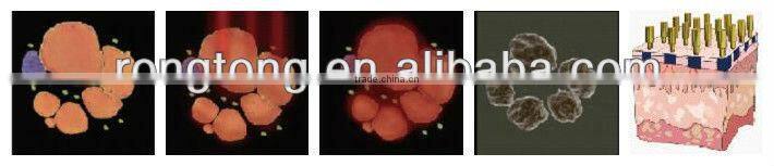 2015 best selling machine smart lipo machine laser cutting machine