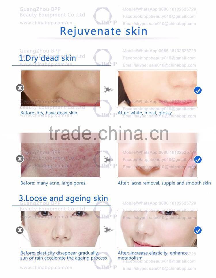 Cheapest price micro dermabrasion for accelerate metabolism and deep clean /grind the dead skin