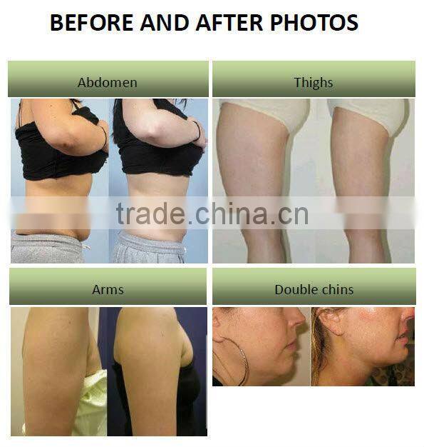 Apolomed diode lipo laser and capacity RF slimming platform