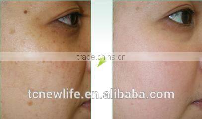 NL-PDT500 BEST ! 2016 Salon Equipment PDT Therapy Machine LED Light Red Blue Yellow for Skin Whitening