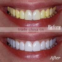 Teeth Whitening Strips CE & FDA Approved
