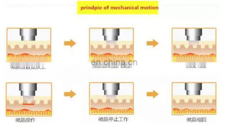 2021 high quality unique micro needles good pricefacial and body lose weight RF microneedle skin tightening machine