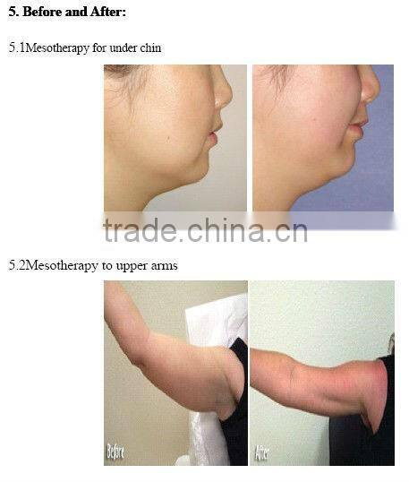 VY-798 Hot sell injection mesotherapy gun products for skin rejuvenation