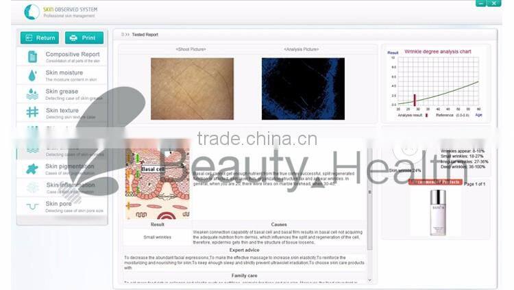 OEM new portable facial skin analyzer machine to check skin health