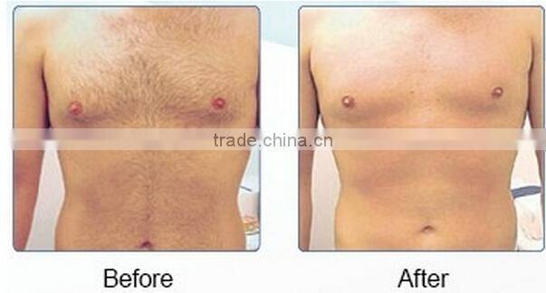 Newest SHR and IPL Promotion !! Only USD2750 Beauty salon/clinic use super hair removal device ipl/shr beauty euipment