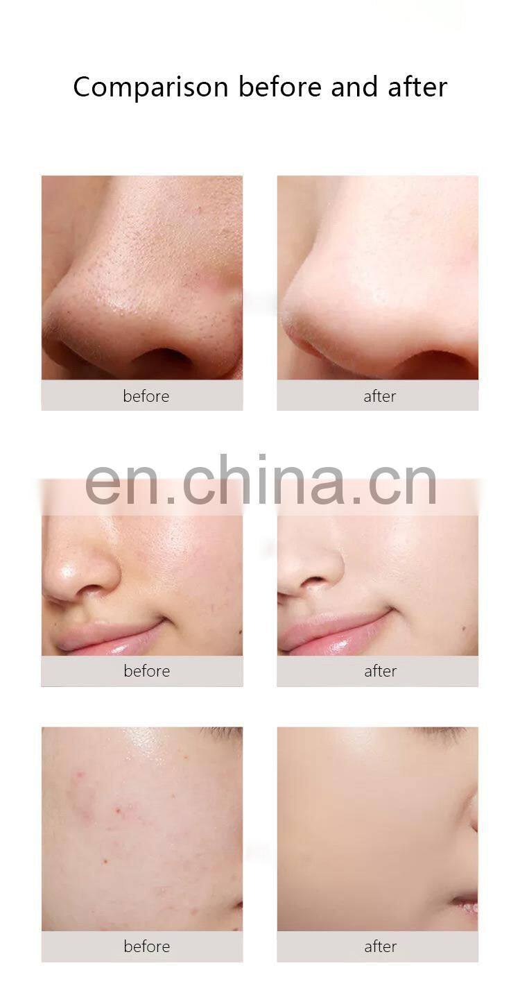 Diamond microdermabrasion bio microcurrent face lifting oxygen peeling deep cleaning machine with skin analysis and PDT system