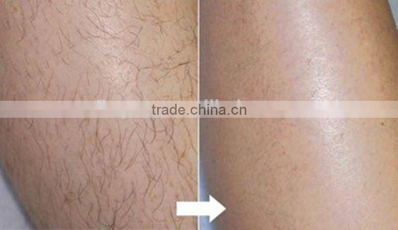 Hot Sale 3 in 1 hair removal pulsed light New Hair Loss Treatment