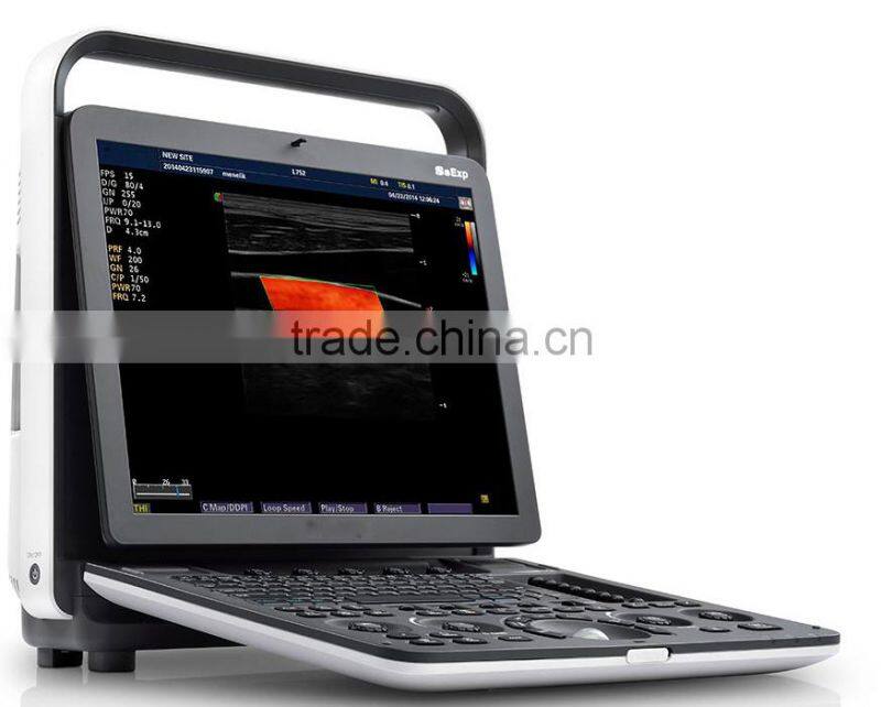 Loptop Fully Digital Ultrasound Scanner Ultrasound scanner Color Doppler