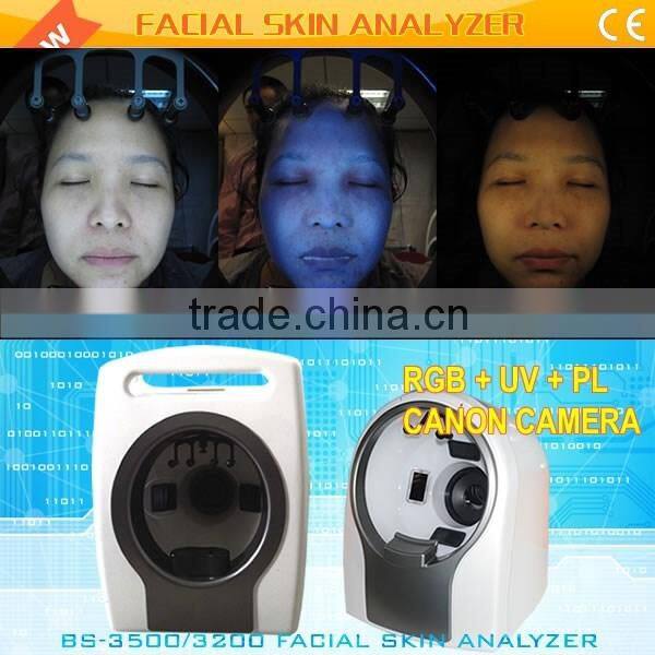 Hot-selling made in China smart system digital dermatoscope professional portable 3d skin analyzer
