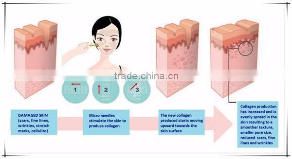 2016 derma rolling system micro needles skin care roller with 1200 needles