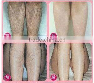 ND Yag Brown Hair Removal Physiotherapy Device