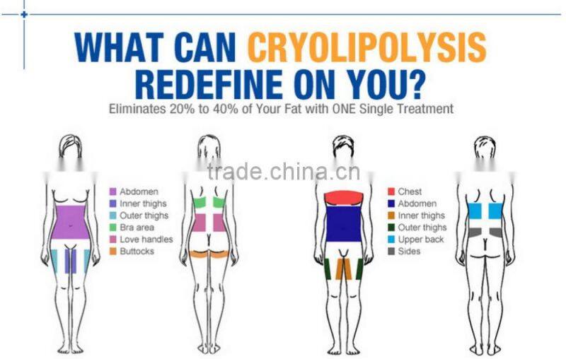 BD06C Portable cryolipolysis fat freeze slimming machine