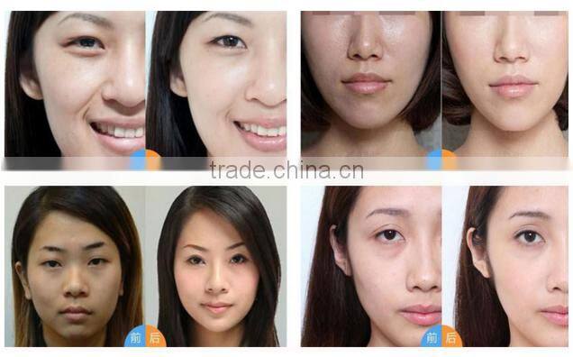 Merry christmas! Korea imported mesotherapy gun skin whitening injection 5 pin multi needle type machine