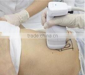 Merry christmas! professional high intensity focused ultrasound slimming weight balance lipo hifu machine