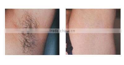 2012 vertical hot e-light advanced IPL hair removal function+ newest RF skin lifting system+skin cooling technologies,use he