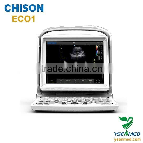 medical 2d Chison eco b w portable ultrasound machine