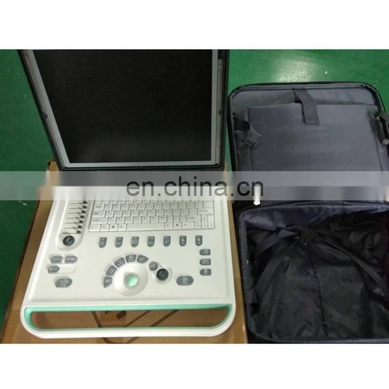 HC-A006B Full digital 15 inch Laptop Ultrasound machine with competitive price(ARM based)