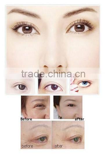 acne skin care dark circles remove machine under eye wrinkle treatment