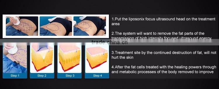 2016 Distributed wanted fat loss slimming device 13mm hifu cartridge