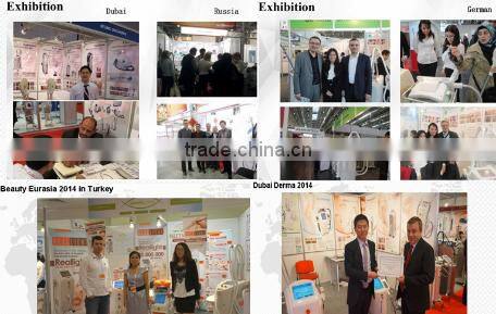 latest Vertical Q-Switched nd YAG Laser Tattoo Removal nevus removal machine