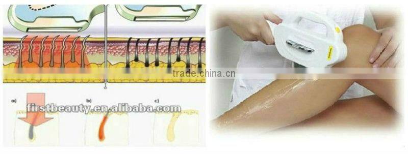 Hot selling beauty salon machine anti aging digital IPL Hair Removal and Skin Rejuventation Machine A006