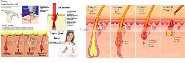 High quality and low price! Professional diode laser/808nm diode laser/laser hair removal for permanent hair removal
