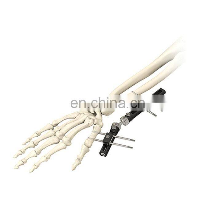 High Quality Wrist Joint External Fixator Orthopedic Surgical Instrument