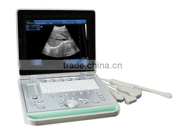 3d Ultrasound Machine