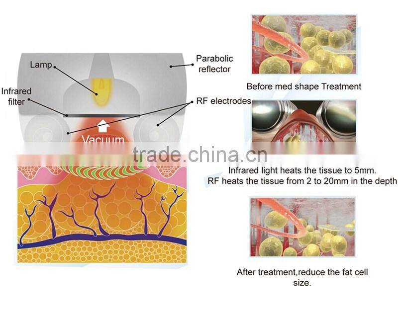 Kumashape Safe and enjoyable slimming IR RF vacuum Rolling massage beauty device