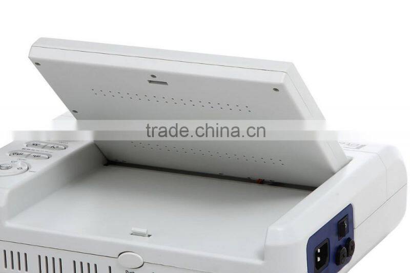 Hot Sale Model 8.4-inch screen color LCD display, Portable Fetal Monitor for single twins optional with printer-Shelly